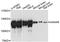Glucosidase II Alpha Subunit antibody, A13851, ABclonal Technology, Western Blot image 