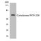 Cytochrome P450 Family 2 Subfamily D Member 6 antibody, LS-C291857, Lifespan Biosciences, Western Blot image 