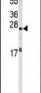 Eukaryotic translation initiation factor 4E antibody, PA5-24582, Invitrogen Antibodies, Western Blot image 