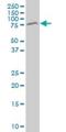 Methyl-CpG Binding Protein 2 antibody, H00004204-M03, Novus Biologicals, Western Blot image 