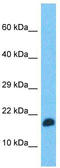 Transcription elongation factor, mitochondrial antibody, TA332105, Origene, Western Blot image 