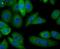 Alcohol Dehydrogenase 1A (Class I), Alpha Polypeptide antibody, NBP2-75398, Novus Biologicals, Immunocytochemistry image 