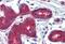 PTCH1 antibody, NB100-2451, Novus Biologicals, Immunohistochemistry paraffin image 