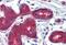 Patched 1 antibody, NB100-2451, Novus Biologicals, Immunohistochemistry paraffin image 