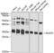 Nudix Hydrolase 5 antibody, 13-687, ProSci, Western Blot image 