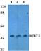 Homeobox C12 antibody, PA5-37170, Invitrogen Antibodies, Western Blot image 