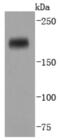 DNA Methyltransferase 1 antibody, NBP2-66805, Novus Biologicals, Western Blot image 