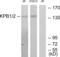 Phosphorylase Kinase Regulatory Subunit Alpha 1 antibody, abx013495, Abbexa, Western Blot image 