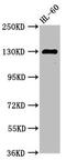 Signal-Induced Proliferation-Associated 1 antibody, LS-C671456, Lifespan Biosciences, Western Blot image 