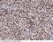 Protein Kinase, DNA-Activated, Catalytic Subunit antibody, 101038-T08, Sino Biological, Immunohistochemistry paraffin image 