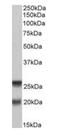 Synaptosome Associated Protein 23 antibody, orb125027, Biorbyt, Western Blot image 