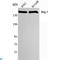 SWI/SNF Related, Matrix Associated, Actin Dependent Regulator Of Chromatin, Subfamily A, Member 4 antibody, LS-C812897, Lifespan Biosciences, Western Blot image 