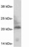 Caveolin 3 antibody, ALX-210-241-C100, Enzo Life Sciences, Western Blot image 