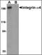 CD49D antibody, orb89167, Biorbyt, Immunohistochemistry paraffin image 
