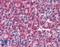 Receptor Interacting Serine/Threonine Kinase 2 antibody, LS-B1394, Lifespan Biosciences, Immunohistochemistry paraffin image 