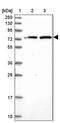 Kelch Repeat And BTB Domain Containing 8 antibody, PA5-59503, Invitrogen Antibodies, Western Blot image 