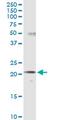 Sodium Channel Modifier 1 antibody, MA5-24489, Invitrogen Antibodies, Western Blot image 