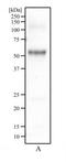 Plasmalemma Vesicle Associated Protein antibody, NB100-77668, Novus Biologicals, Western Blot image 