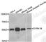 Dual Specificity Tyrosine Phosphorylation Regulated Kinase 1B antibody, A4276, ABclonal Technology, Western Blot image 