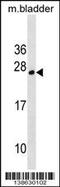 TPD52 Like 1 antibody, 60-103, ProSci, Western Blot image 