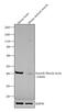 Actin Alpha 2, Smooth Muscle antibody, MA5-15805, Invitrogen Antibodies, Western Blot image 