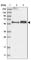 TSPY Like 1 antibody, HPA031970, Atlas Antibodies, Western Blot image 