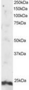 ADP Ribosylation Factor Like GTPase 4A antibody, TA302814, Origene, Western Blot image 