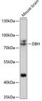 Dopamine Beta-Hydroxylase antibody, A01110-1, Boster Biological Technology, Western Blot image 