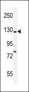 Kinesin Family Member 5C antibody, LS-C165520, Lifespan Biosciences, Western Blot image 