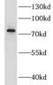 Lipoma-preferred partner antibody, FNab04835, FineTest, Western Blot image 