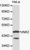 Mitogen-Activated Protein Kinase 9 antibody, LS-C192672, Lifespan Biosciences, Western Blot image 