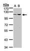 Ubiquitin Specific Peptidase 5 antibody, PA5-28243, Invitrogen Antibodies, Western Blot image 
