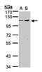 Ubiquitin Specific Peptidase 5 antibody, PA5-28243, Invitrogen Antibodies, Western Blot image 