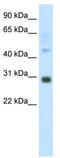 Distal-Less Homeobox 5 antibody, TA343518, Origene, Western Blot image 