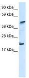 IKAROS Family Zinc Finger 5 antibody, TA333705, Origene, Western Blot image 
