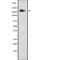 Collagen Type V Alpha 3 Chain antibody, abx149454, Abbexa, Western Blot image 