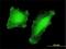 Lysine Acetyltransferase 2B antibody, H00008850-M01, Novus Biologicals, Immunocytochemistry image 