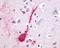 Lysophosphatidic Acid Receptor 4 antibody, NLS1895, Novus Biologicals, Immunohistochemistry frozen image 
