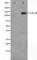 Neurotrophic Receptor Tyrosine Kinase 2 antibody, abx012017, Abbexa, Western Blot image 