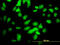 Component Of Inhibitor Of Nuclear Factor Kappa B Kinase Complex antibody, LS-C133119, Lifespan Biosciences, Immunofluorescence image 