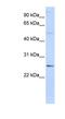Ferritin Heavy Chain Like 17 antibody, NBP1-59998, Novus Biologicals, Western Blot image 