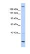 Trinucleotide Repeat Containing Adaptor 6B antibody, NBP1-57549, Novus Biologicals, Western Blot image 