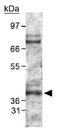 Egl-9 Family Hypoxia Inducible Factor 1 antibody, GTX82966, GeneTex, Western Blot image 