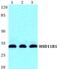 Hydroxysteroid 11-Beta Dehydrogenase 1 antibody, GTX66731, GeneTex, Western Blot image 