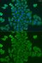 Dolichol-phosphate mannosyltransferase antibody, GTX33163, GeneTex, Immunofluorescence image 