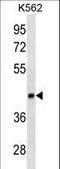 Lymphoid Enhancer Binding Factor 1 antibody, LS-C157858, Lifespan Biosciences, Western Blot image 