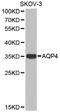 Aquaporin 4 antibody, LS-B13382, Lifespan Biosciences, Western Blot image 