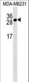 TNF Receptor Superfamily Member 17 antibody, LS-C162064, Lifespan Biosciences, Western Blot image 