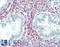 Fibroblast Growth Factor 23 antibody, LS-B15269, Lifespan Biosciences, Immunohistochemistry paraffin image 