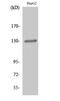 EPH Receptor B1 antibody, STJ92948, St John